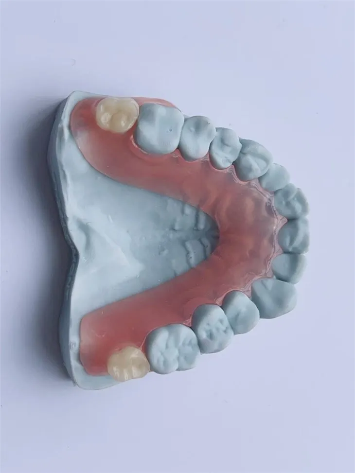 Pristupačna 3D print DENTALNA Djelomična fleksibilna proteza
