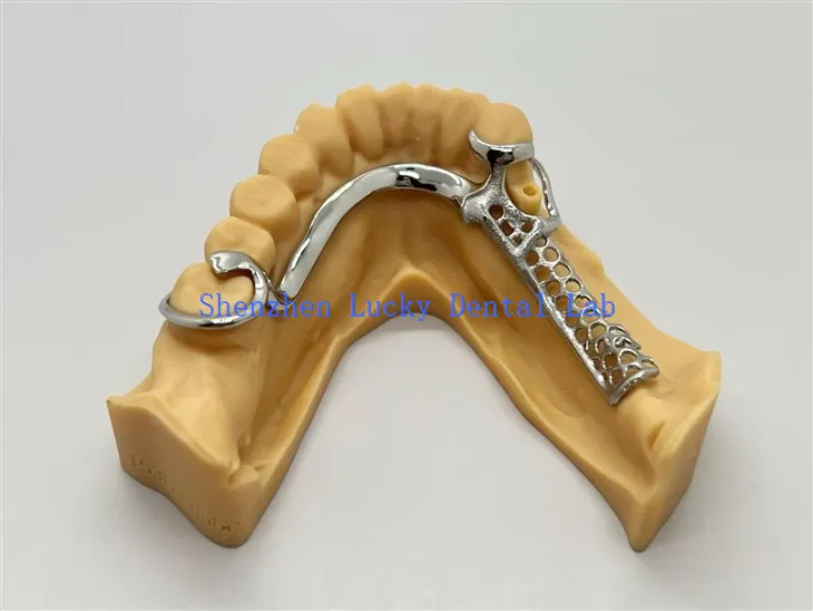 Cobalt Chrome Frameworks