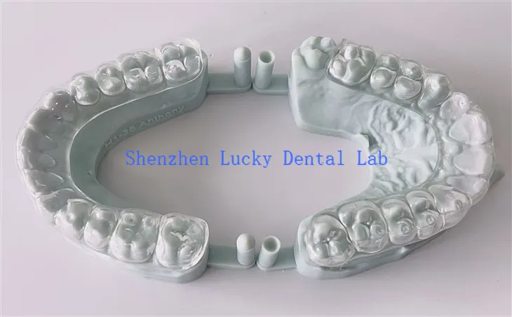 Udobne 3D Print Hard Night Guard proizvođači