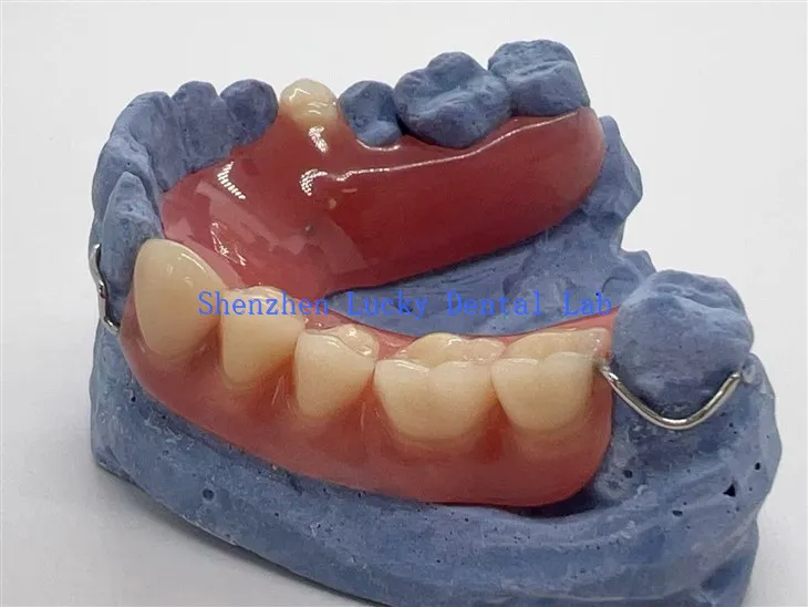 Udobna djelomična akrilna proteza sa kopčom za žicu