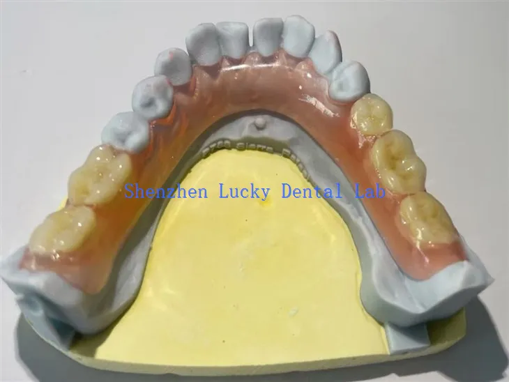 Udobne djelomične fleksibilne proizvođače zubne proteze