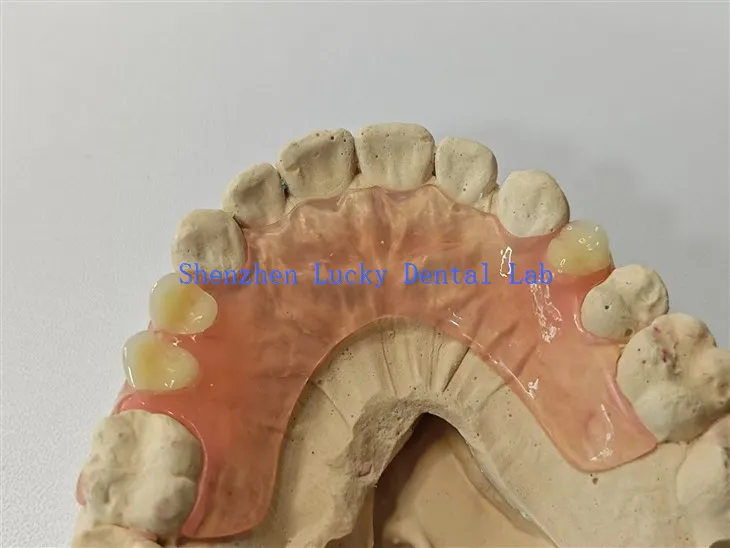 Udobna fleksibilna zubna laboratorija za protezu