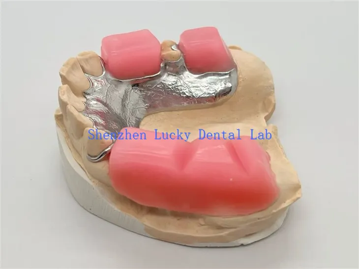 Metalni okvir sa ugrizom