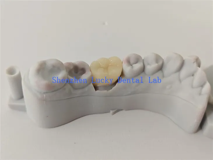 Prirodna stomatološka tvornica Crown Crown Crown