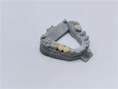 Autentične krunice od cirkonija China Dental Lab