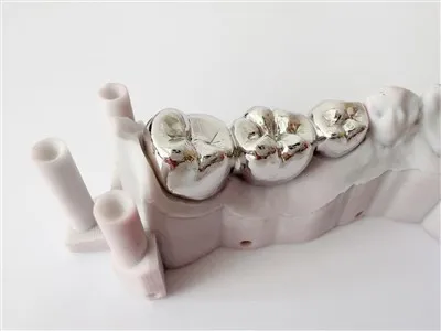 Prilagođeno 3D print zubnu cijelu metalnu krunu