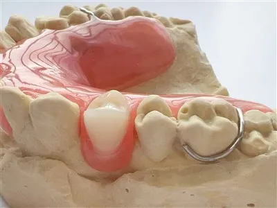 Zubna djelomična akrilna proteza sa kopčom za žicu